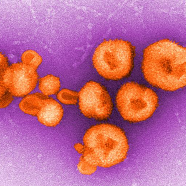 lassa-arenaviridae-cdc.jpg