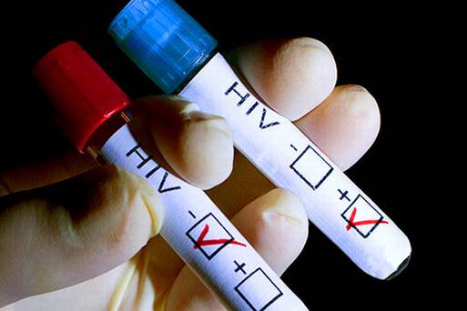 hiv-test-stock.jpg