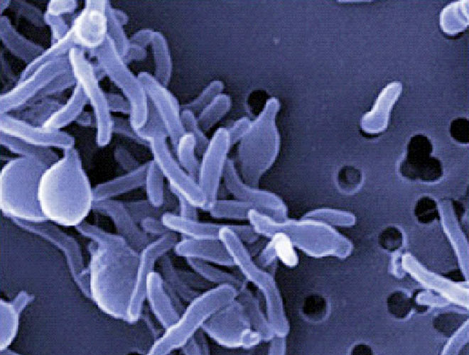 virus_660_032713101216